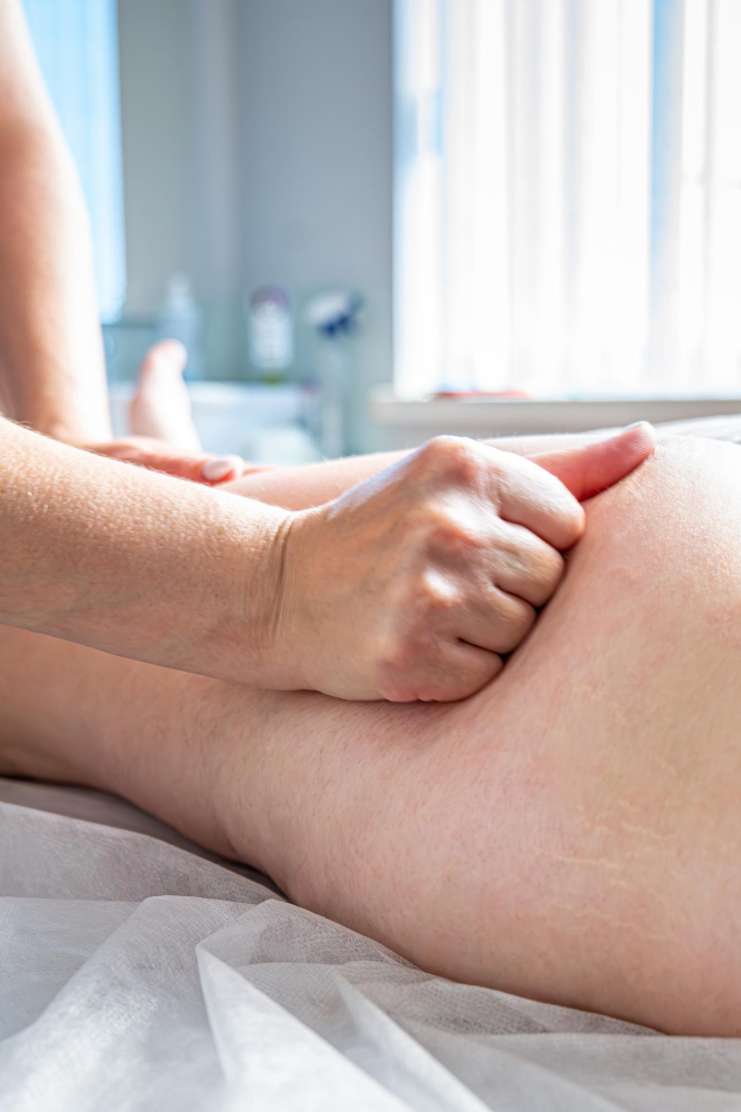 Drenagem para Lipedema